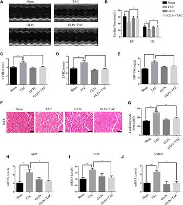 Ganoderma lucidum polysaccharides attenuates pressure-overload-induced pathological cardiac hypertrophy